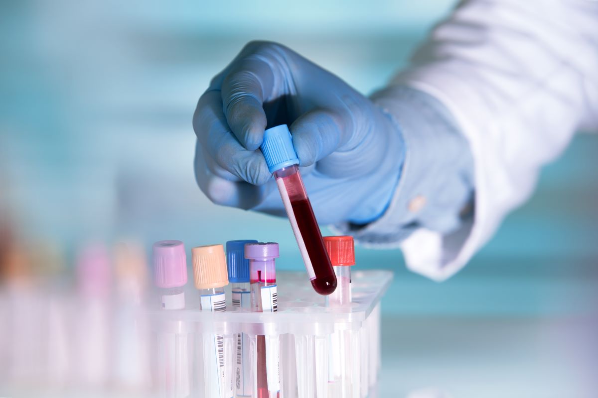 血液検査で最大7年早くがん発見の可能性、予防治療法の開発に期待　英研究