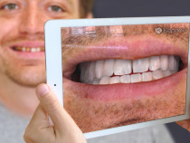 拡張現実を歯科で活用する