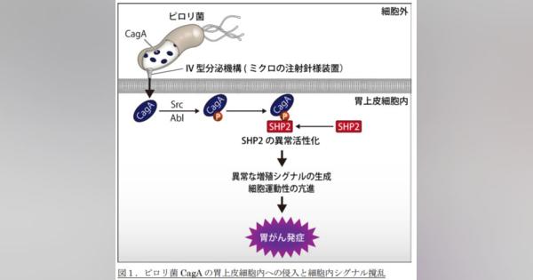胃がんの多い日本人　原因はピロリ菌が作るタンパク質　東大の研究で判明