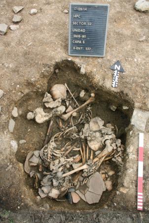 ペルー出土の頭骨に陥没痕　古代の儀礼か