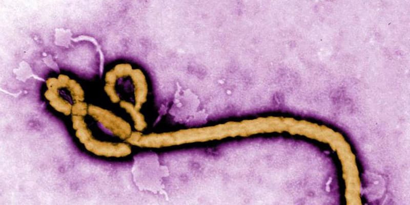 エボラウイルス 今夏にも輸入 五輪に備え 検査目的で感染研
