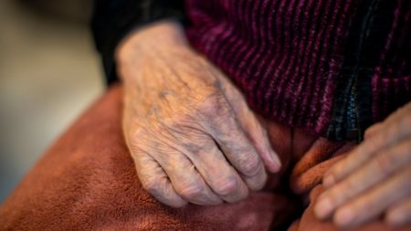 人より早く老いる ウェルナー症候群 の患者は なぜ日本人が多いのか 遺伝性難病の老化のメカニズムを探る