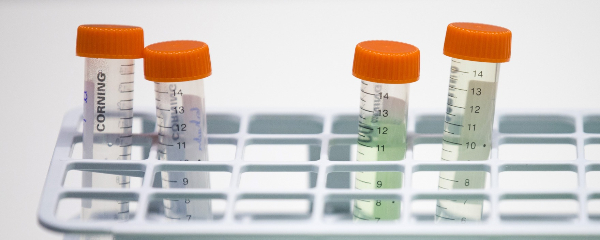 遺伝子治療薬で初の医療保険適用 血管詰まる病気の患者対象