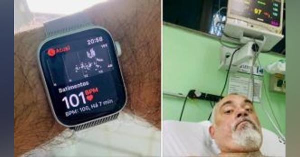 Apple Watch、ブラジル男性に頻脈を警告して命を救う