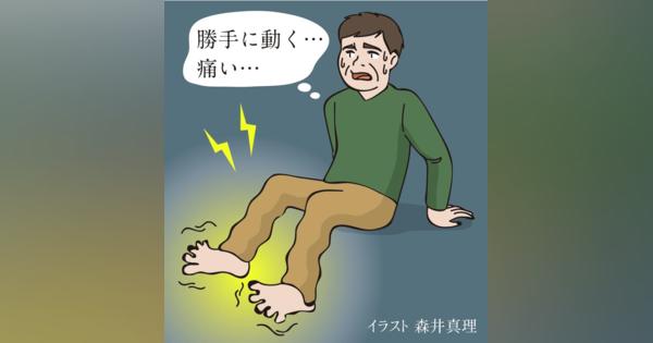 【痛みを知る】「痛む足動く趾症候群」　足指がくねって動く　森本昌宏