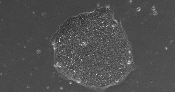 活性酸素少ない細胞からヒトiPS細胞作製で、DNA損傷抑えられる　日・カナダの研究チーム発表