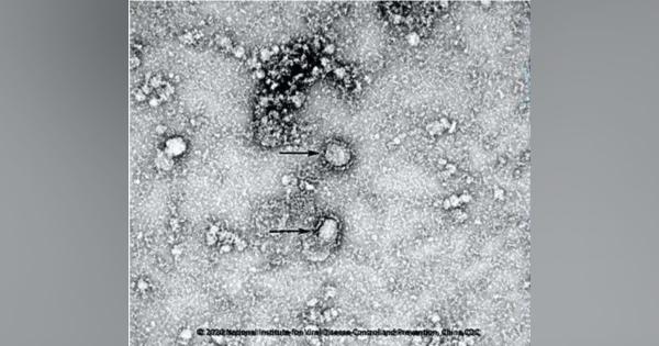 中国で初めて新型コロナウイルスの分離に成功、疾病予防控制センターが電子顕微鏡写真を公開