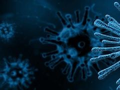 新型コロナウイルス、製造業における欧米各社の対応は