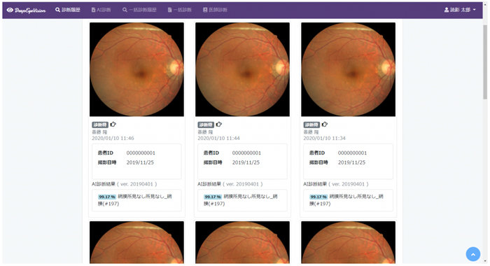 AIが「眼底画像」を診断、眼科医向けの診断支援サービスが登場
