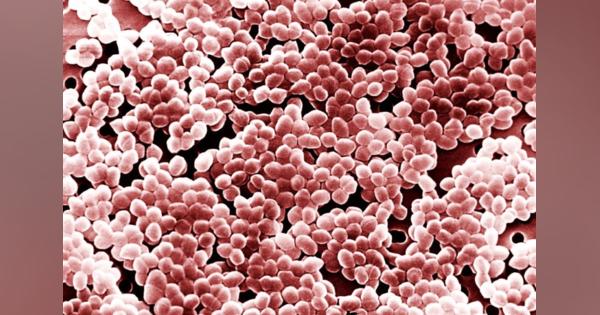 抗生物質が効かない「薬剤耐性菌」に打ち勝つヒントを、科学者たちが見つけ出した