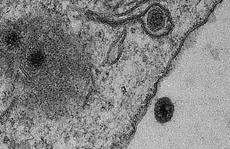 未知の遺伝子を持つ新しいウイルスがブラジルで発見される