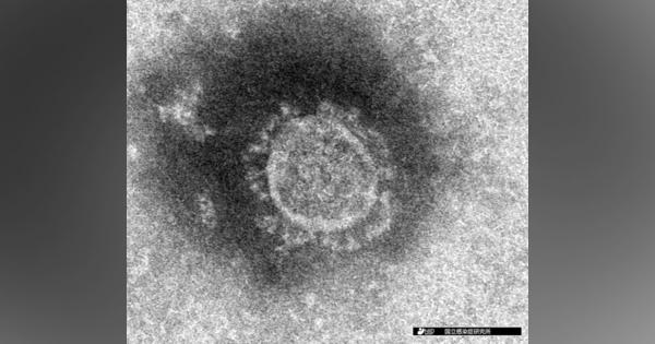 新型コロナウイルス、北海道の感染男性は基礎疾患なし