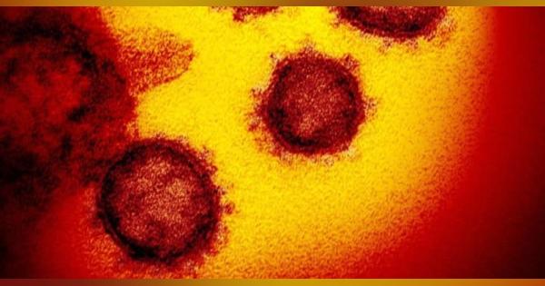 致死率SARSより低い2％　新型肺炎、軽症8割