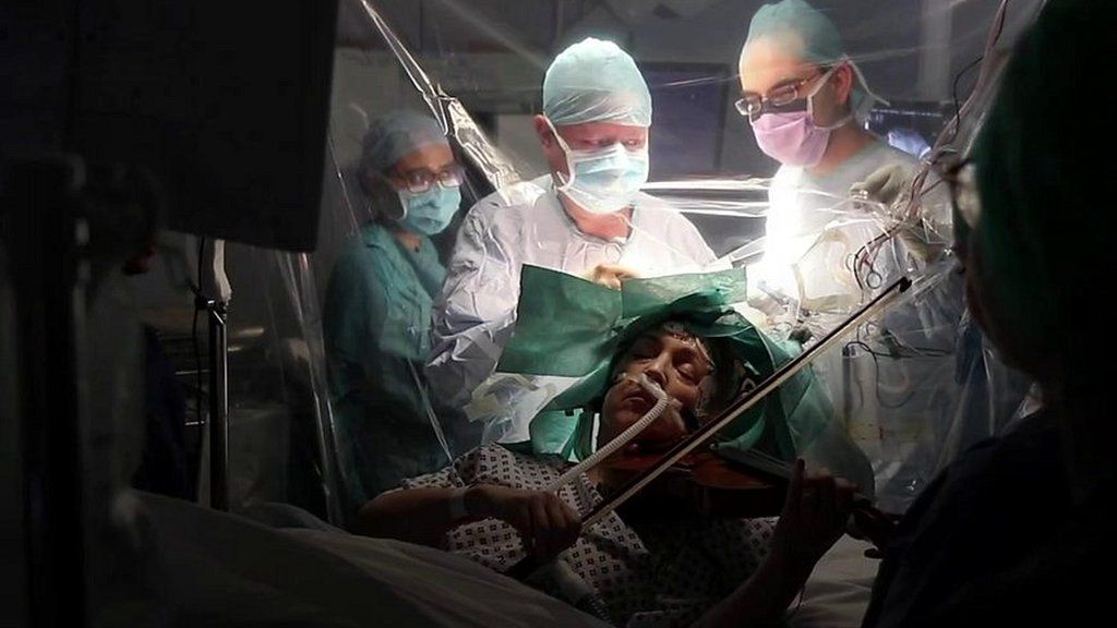 脳の手術中にバイオリンを演奏、患者の左手を守るため　英病院