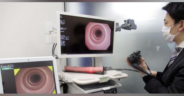 AIで大腸画像から病変を検出　オリンパス5月発売、精度95％