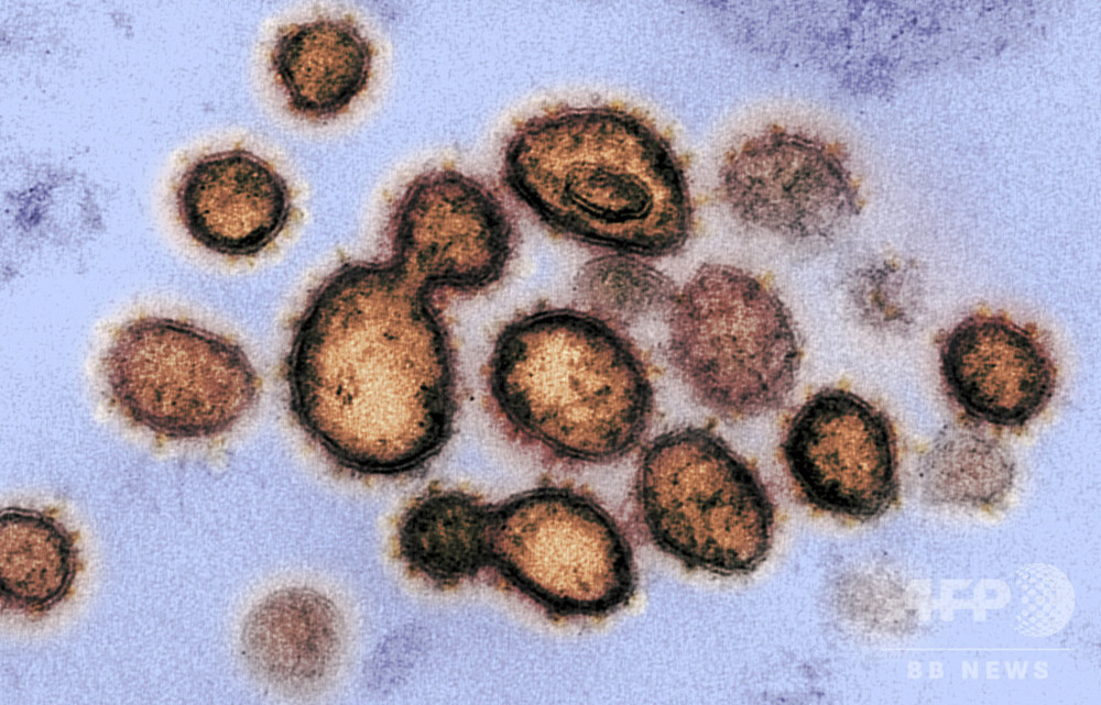 感染者の部屋やトイレに新型ウイルス残留、清掃すれば死滅 研究報告