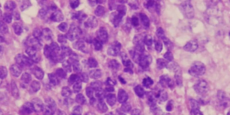 iPS細胞から肝臓がん作製　岡山大、予防や治療法発見へ期待