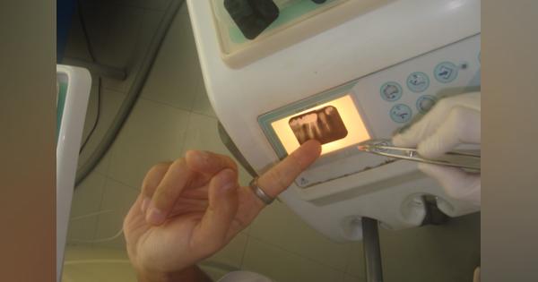 タイの歯科医を呆れさせた、恐るべき日本の歯科の非常識
