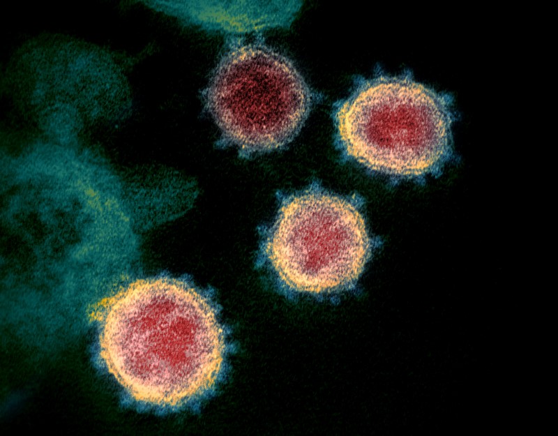 新型コロナ、発症1─3日前からウイルス感染か＝ＣＤＣ調査
