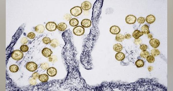中国で発症3時間後に死亡 「ハンタウイルス」感染拡大の可能性は？ | 中国ニュース拾い読み