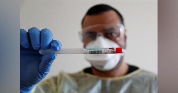 新型コロナウイルス、男性の死亡リスクが高い理由