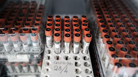 【新型コロナ】回復者の血液サンプルが価格高騰中「血漿ビジネス」の実態 | 抗体検査を大量実施したくても血液不足…