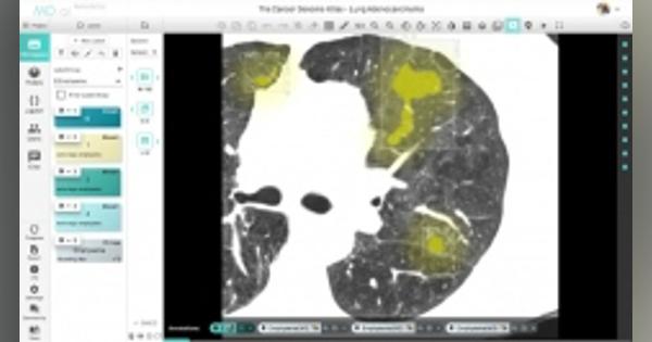 NTTデータと岩手医大、AIによる画像診断システムを実証実験