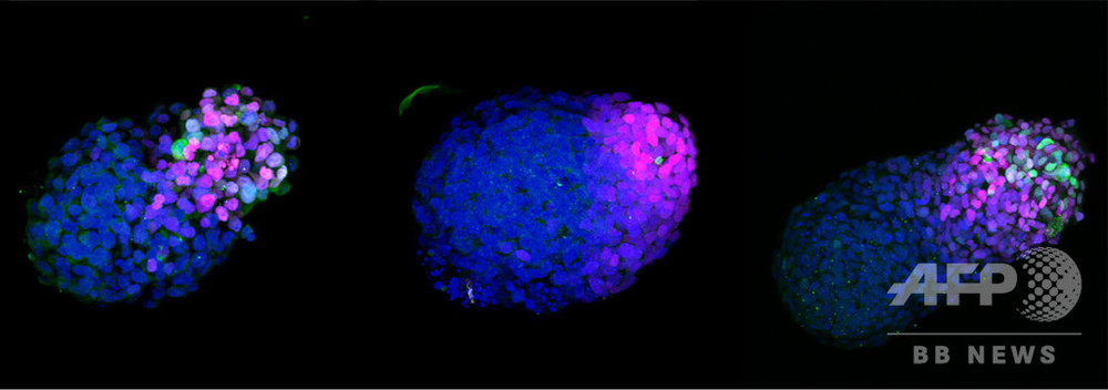 幹細胞からヒト胚「モデル」作製、原腸形成期の解明に光