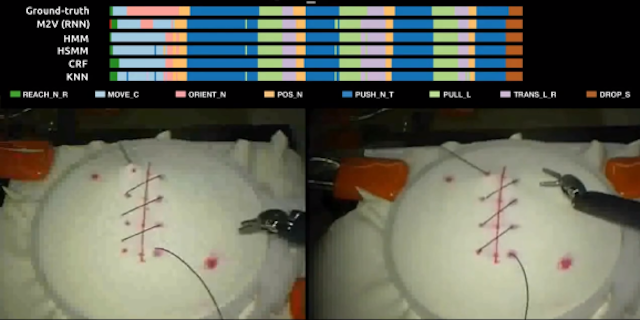 外科手術ロボットが動画を見て縫合トレーニングを実施、Google Brainらがテスト