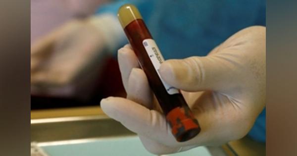新型コロナ感染、血液Ａ型は重症化リスク高い可能性＝研究 - ロイター