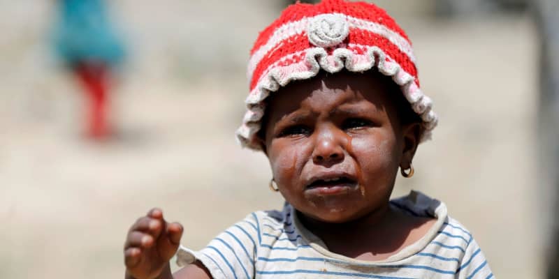 中東イエメン幼児、栄養失調増　ユニセフ「世界最悪の人道危機」