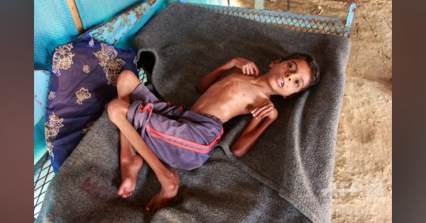 イエメンで1000万人以上が深刻な食糧不足、人道危機が急激に悪化 WFP