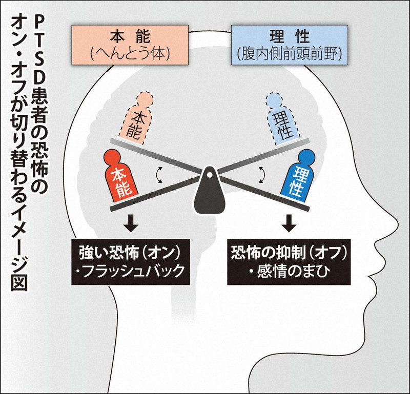 PTSD患者脳内で恐怖のオン・オフ繰り返す仕組み明らかに　民間研究機関ATR