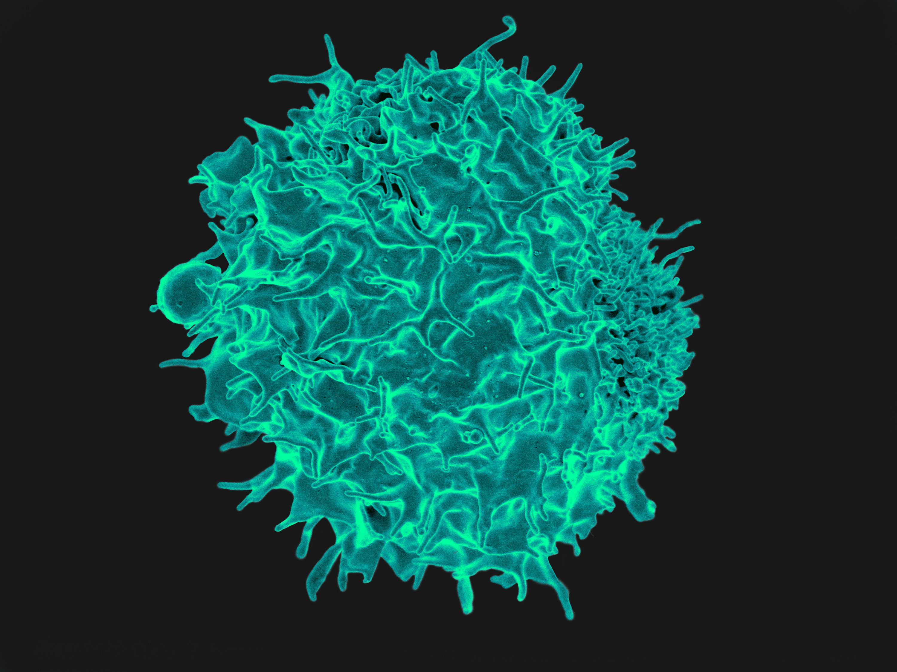 抗体消滅問題、「免疫パスポート」の鍵は「T細胞」　未感染者が新型コロナに抵抗力を持っていた理由