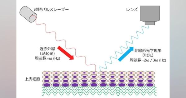 イメージングで、組織を切らずにその場でがん診断ができる技術を開発