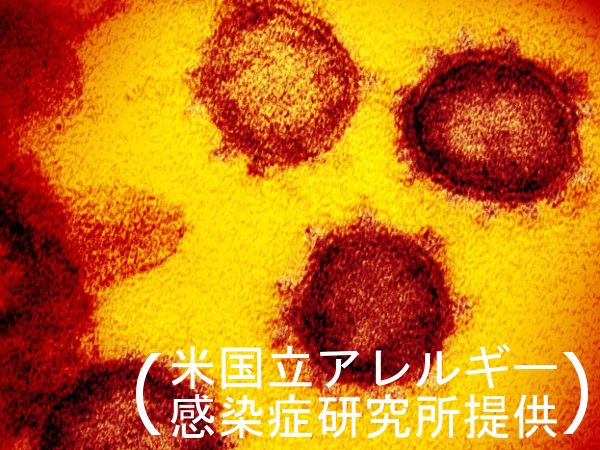 徳島県内の20代男性、香川で感染確認