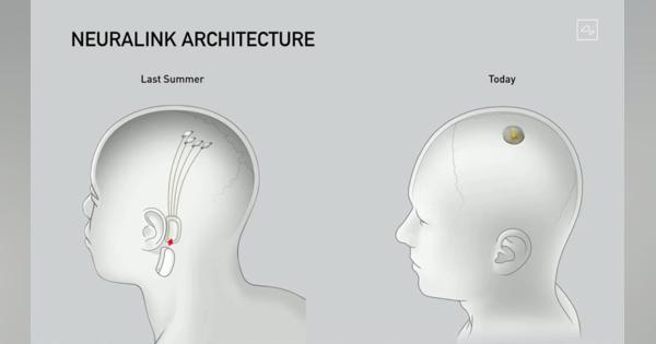 イーロン・マスクのNeuralink、脳埋め込みチップのブタでのデモで進捗報告