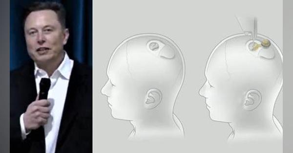 イーロン・マスクが進める「脳とコンピュータをつなぐ技術」、ここまで来た