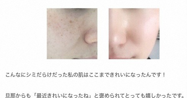 グノシーの虚偽広告　東京都が行政指導　医薬品医療機器法違反