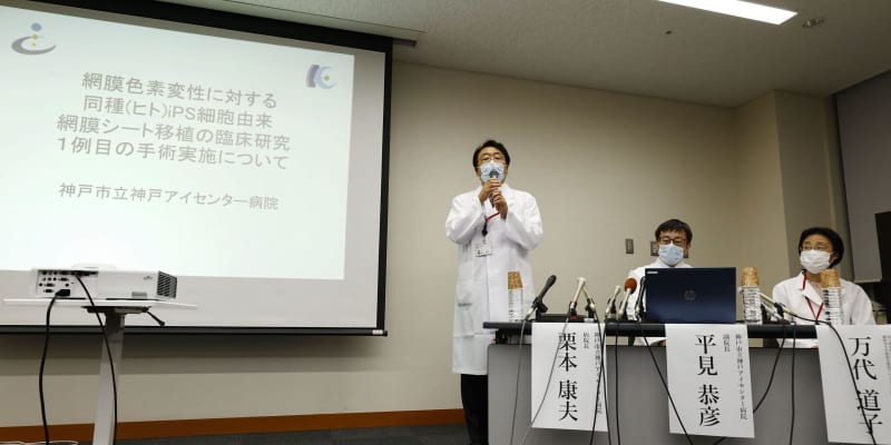 iPS視細胞移植を発表、世界初　神戸アイセンター、網膜に疾患