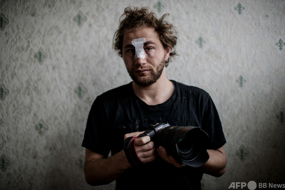シリア人写真家が仏パリのデモで負傷、よみがえる内戦の記憶