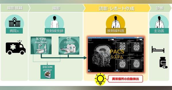 NTTデータとNTT東日本関東病院、胸部CTの診断プロセスへのAI画像診断技術の適用を目指し共同検証を開始