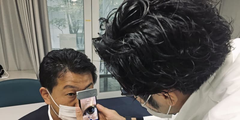 AIの遠隔診断で白内障を判別　日本初、スマホで映像分析