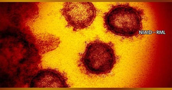 新型コロナウイルス 東京都で新たに856人の感染確認　火曜日最多