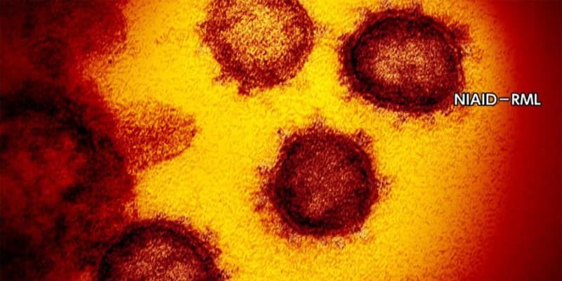 新型コロナウイルス 東京都で新たに856人の感染確認　火曜日最多