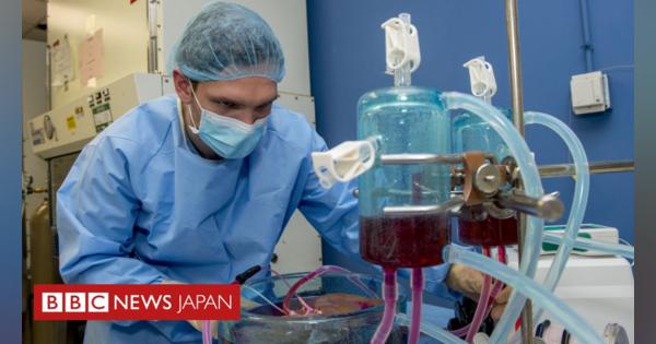 移植臓器、「過冷却」で保存期間3倍に＝米研究