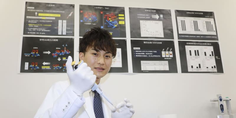古い血痕、新手法で検出可能に　福井県警科捜研が開発