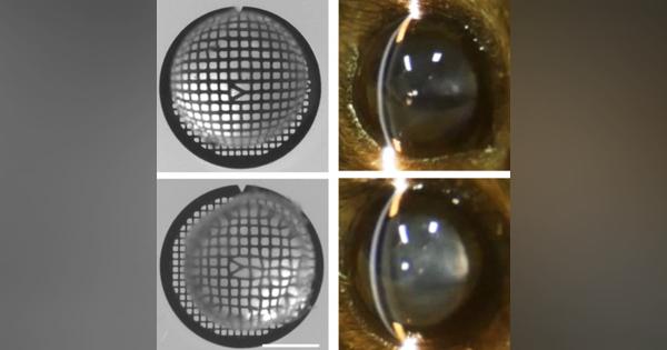 目の水晶体、透明化の謎解明　酵素で細胞小器官分解―東大：時事ドットコム