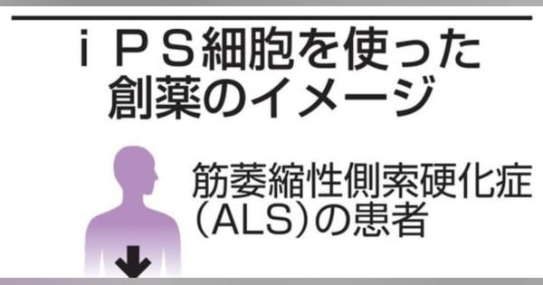 難病ALSの進行抑制に効果の薬　iPSで発見、慶大「世界初」