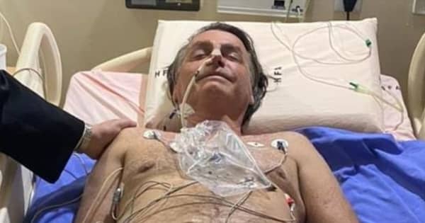 ブラジル大統領、しゃっくり止まらず　腹部の検査で入院